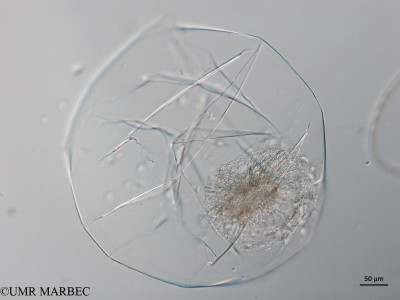 phyto/Brazilian_Nordeste/Northeastcoast_station28/ABRACOS2 April 2017/Noctiluca scintillans (Snap-163))(copy)_thumb.jpg